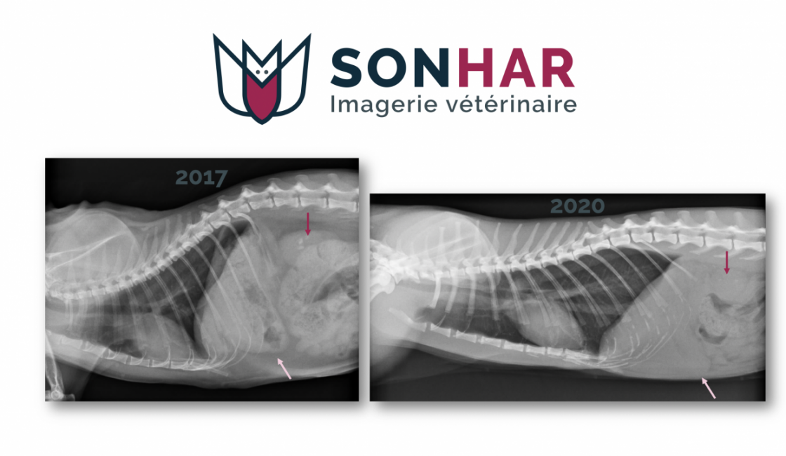 Embonpoint et contraste radiographique